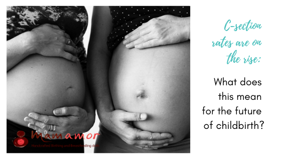 C-section rates are on the rise: What does this mean for the future of childbirth?